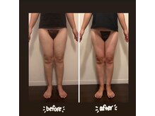 salon結(yui)/下半身むくみ、痩身メニュー☆