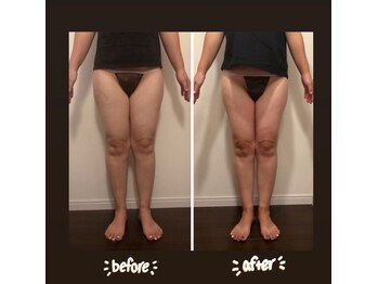 salon結(yui)/下半身むくみ、痩身メニュー☆