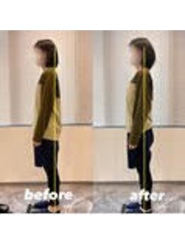 スリーエス 梅田スタジオ(SSS)/施術効果 姿勢改善