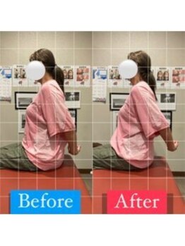 ナオル整体 宮崎院(NAORU整体)/40代女性施術事例【肩可動域】