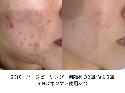 リンフェイス 表参道(RIN FACE)の写真