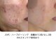 リンフェイス 表参道(RIN FACE)の写真