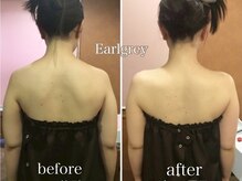 エステティックサロン アールグレー 名古屋駅店/効果実感◎ブライダル痩身エステ