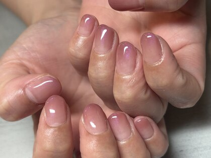 フロッシュ(FROSCH)の写真