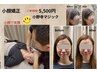 【歴18年の神業♪】結果が違う！持続する小顔☆小顔矯正　¥5980