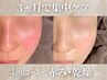 <赤みのお悩みに|初回限定>赤み集中肌管理4回コース|毎月3名まで