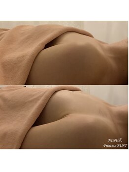 メイ(May)/20代 バストアップ 未授乳