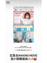 ホワイトニングビューティー 名古屋栄店(WHITENING BEAUTY)/セルフホワイトニング