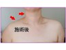 【たるみケア】顔筋EMS！本気でたるみ改善 90分 ¥14,080