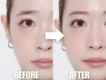 リノモア(LinoMoa)