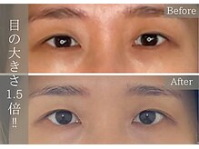 施術後は目元すっきりパッチリ。眼精疲労にも◎