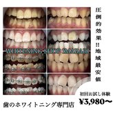 ホワイトニングショップ 今治店