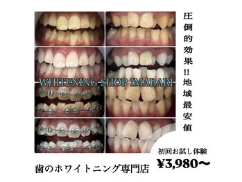ホワイトニングショップ 今治店