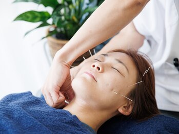 フラット柏(FLAT柏)の写真/フェイスラインやたるみの改善には美容鍼が◎上清液導入で肌のハリツヤがよくなり若見えに♪