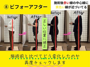 ヒューマン鍼灸接骨院/姿勢の変化を実感！