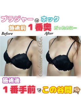 カルマーアンドビー(Calmer & Be.)/【バスト】Before/After