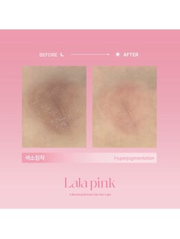 グラッソ(GRASSO)/ララピンク