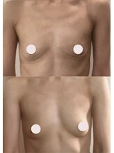 プレジール/バストボリュームアップ