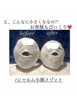 シャルム(CHARME)/大人気な小顔コルギ！