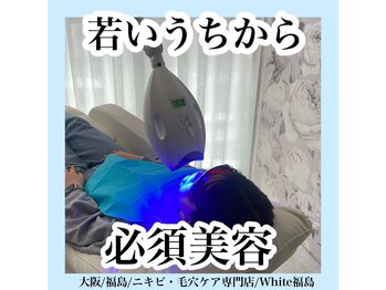 ホワイトニングサロン ホワイト(WHITE)/セルフホワイトニング/大阪/福島