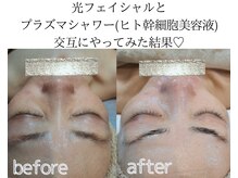 アースコアフュールボーテ ひたち野うしく店(EARTH coiffure beaute)/光フェイシャル