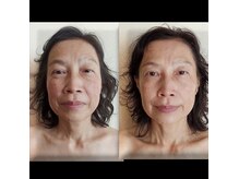 トータルボディーケアサロン ペパーミント 阿佐ヶ谷店の雰囲気（都度払いも人気。首、頭からアプローチするフェイシャルコース）