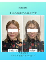 マハロ 海老名店(Mahalo)/小顔矯正　30代女性