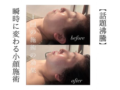 ベルシア(BELXIA)の写真