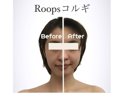 ループス(Roops)の写真