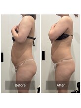 トータルビューティ リライフ(Total beauty Relife)/チノザメソッドでデトックス