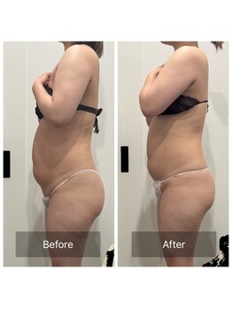 トータルビューティ リライフ(Total beauty Relife)/チノザメソッドでデトックス