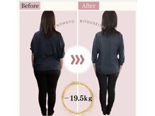 えのもと美容整体院/40代女性