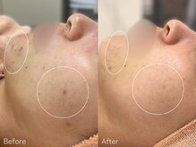 ミュー 栄本店(mieux)/お客様Before/After