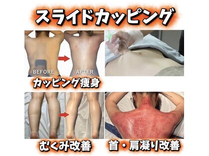 ジュエリーボディー(Jewelry body)の写真