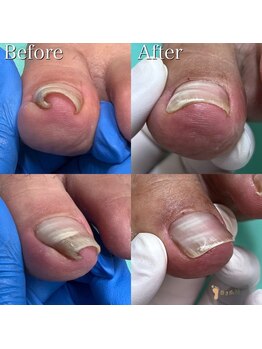 巻き爪補正店 横浜駅前店/