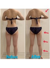 スペチアーレ 夙川/4SET最強痩身