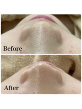 モスト(MOST)/エンビロンフルコース