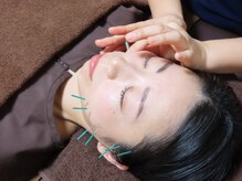 はりめぐり