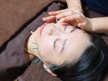 はりめぐりの写真/【人気の美容鍼¥4500】首肩こりや自律神経の乱れ、寝つきが悪い人には体の鍼灸がおすすめ