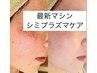 【人気!最新マシン】プラズマ◎集中シミケアし放題30分¥11000→¥9000