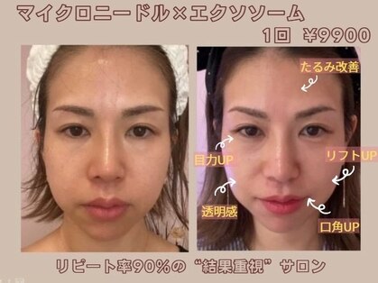 ナナイロ(nanairo)の写真