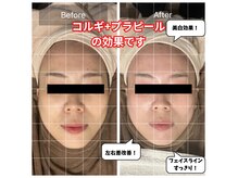 チョアチョア 札幌すすきの店(CHOA-CHOA)の雰囲気(プラピールは当店独自オプション追加で過去最高の仕上がりに♪)