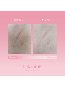 グラッソ(GRASSO)/ララピンク