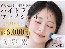 キャンディ 大阪梅田店(CANDi)