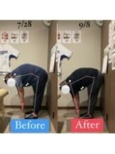 ナオル整体 宮崎院(NAORU整体)/30代男性施術事例【腰痛改善】