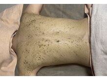 セルヴィノバ(CELL VI NOVA)/＊ボディーハーブピーリング