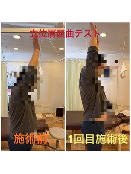 リファイン(Refine)/大きくバンザイができるように