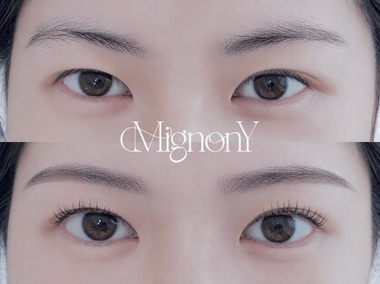 ミニョン ワイ(Mignon Y)の写真