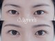 ミニョン ワイ(Mignon Y)の写真