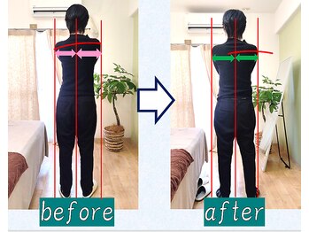 奏流(soryu)/立ち姿勢のお悩み、、、